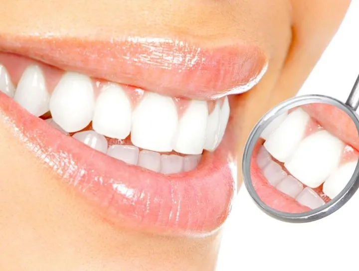 Süt Dişlerine ve Daimi Dişlere Yapılabilen Koruyucu Tedaviler Nelerdir?